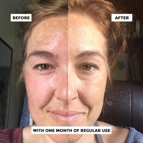 Be Calm - Skin Brightening Vitamin C Serum with Aloe Vera